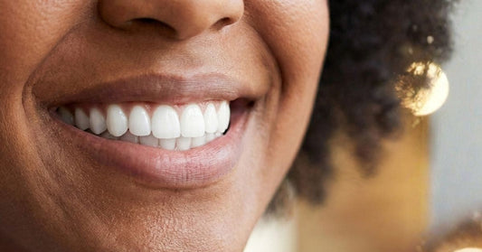 The Myths about Teeth Whitening